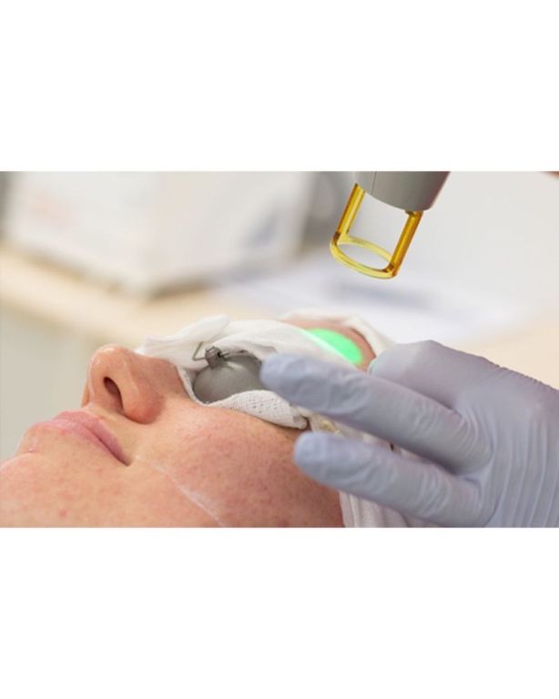 skin-pigmentation-laser-treatment-big-0