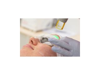 skin-pigmentation-laser-treatment-small-0