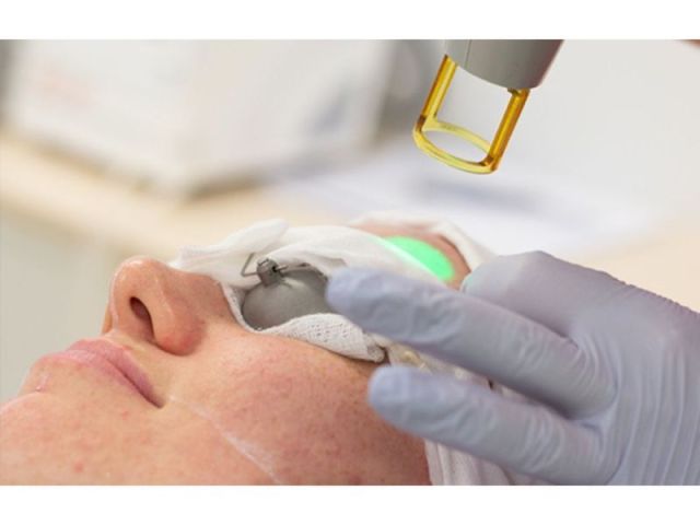skin-pigmentation-laser-treatment