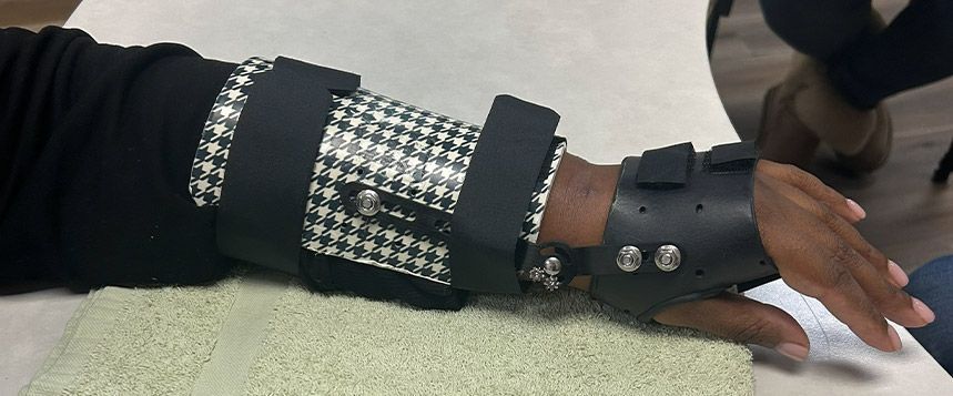 custom-bracing-and-splint-for-wrist-in-bronx-new-york-big-0