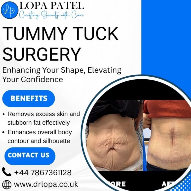 tummy-tuck-surgery-in-uk-big-0