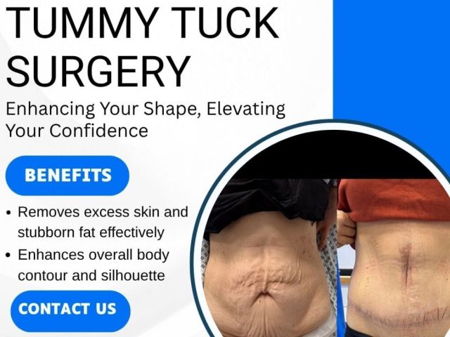 tummy-tuck-surgery-in-uk