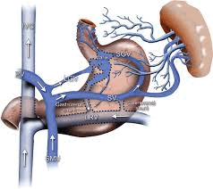 understanding-portal-hypertension-radiology-procedures-big-0