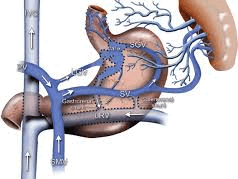 understanding-portal-hypertension-radiology-procedures