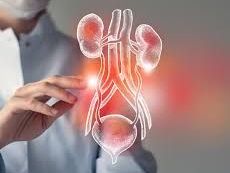 advanced-treatment-for-kidney-cancer-laguna-hills-california