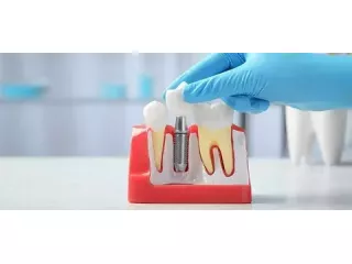 wilmington-dental-implants-specialist-small-0