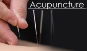 acupuncture-for-headache-in-morristown-fast-natural-relief-big-0
