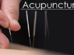 acupuncture-for-headache-in-morristown-fast-natural-relief