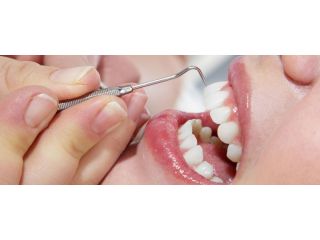 expert-teeth-cleaning-downtown-seattle-for-healthy-smiles-small-0