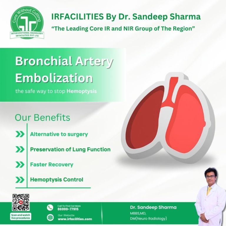 bronchial-artery-embolization-cost-in-india-safe-treatment-big-0