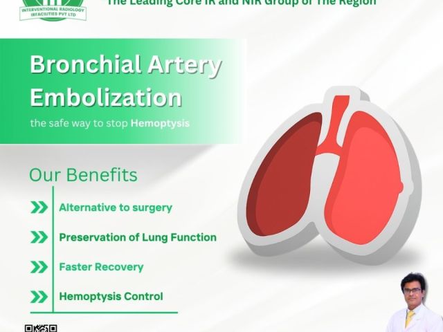 bronchial-artery-embolization-cost-in-india-safe-treatment