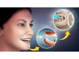 affordable-dental-care-in-springtown-texas-small-0