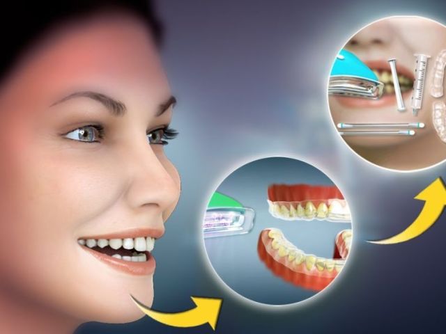affordable-dental-care-in-springtown-texas