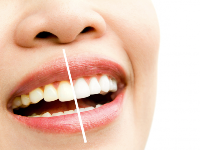 trusted-lake-oswego-orthodontist-services