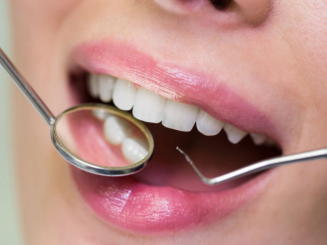 implant-secured-dentures-burton-book-your-appointment-today