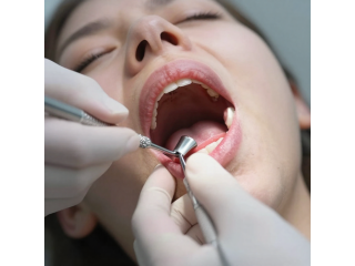 gum-disease-treatment-in-fairless-hills-small-0