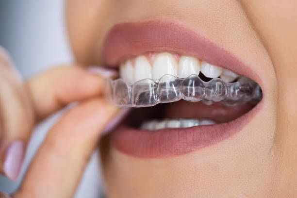 natural-smile-care-with-holistic-dentistry-experts-big-3