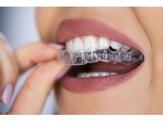 natural-smile-care-with-holistic-dentistry-experts-small-3