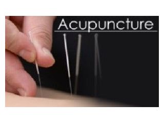 acupuncture-for-vertigo-treatment-in-morristown-expert-care-small-0