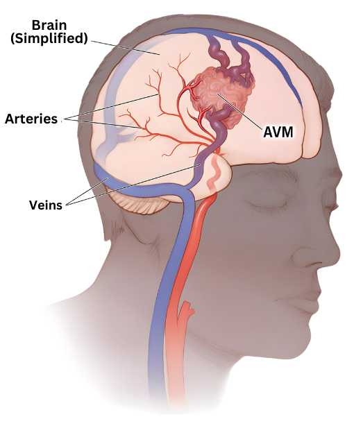 dvt-doctor-in-bilaspur-chhattisgarh-big-0