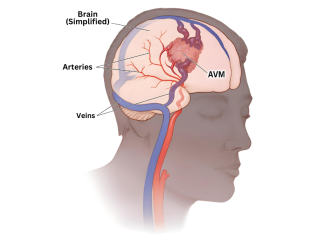 dvt-doctor-in-bilaspur-chhattisgarh-small-0