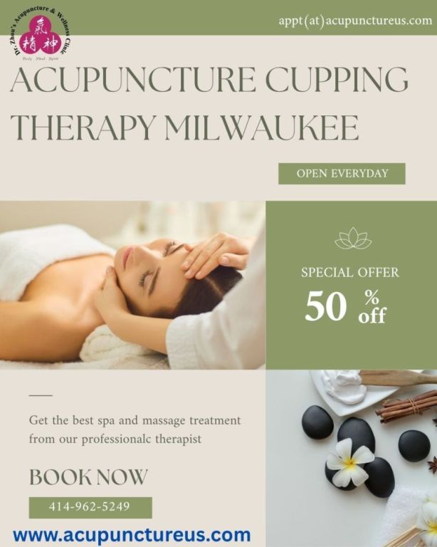 acupuncture-cupping-therapy-milwaukee-big-0