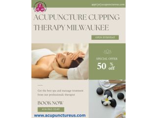 acupuncture-cupping-therapy-milwaukee-small-0