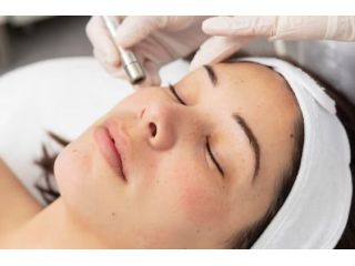 reveal-smoother-brighter-skin-with-microdermabrasion-small-0