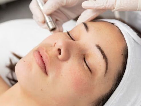 reveal-smoother-brighter-skin-with-microdermabrasion