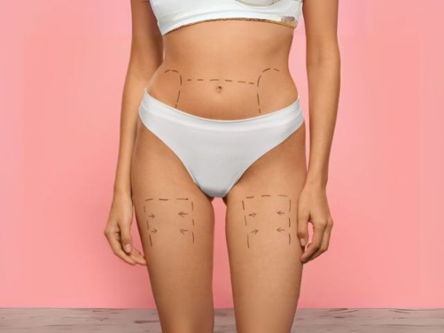 plastic-surgery-atlanta