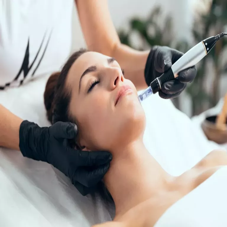 microneedling-tampa-for-smooth-youthful-skin-big-0