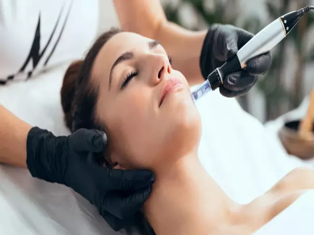 microneedling-tampa-for-smooth-youthful-skin