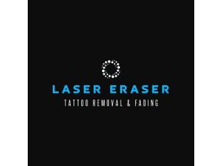 advanced-laser-light-tattoo-removal-for-clearer-skin-small-0