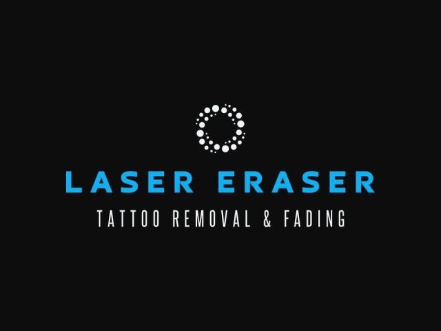 advanced-laser-light-tattoo-removal-for-clearer-skin