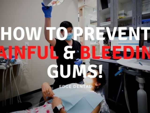 why-should-you-visit-a-gum-disease-specialist-in-houston