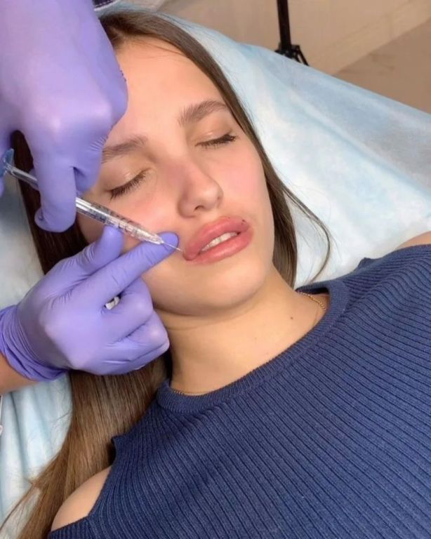 beverly-hills-botox-consultants-big-0