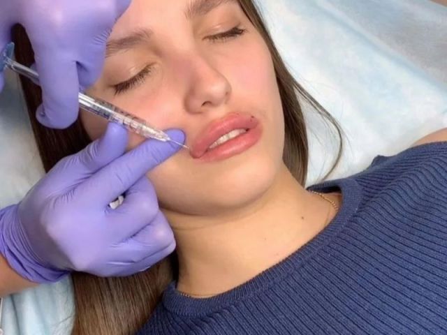 beverly-hills-botox-consultants
