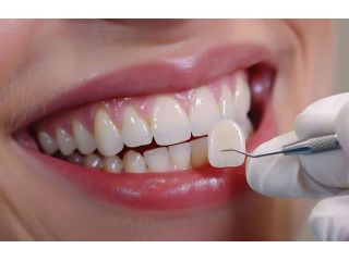 smile-makeover-with-veneers-results-in-north-brunswick-small-0