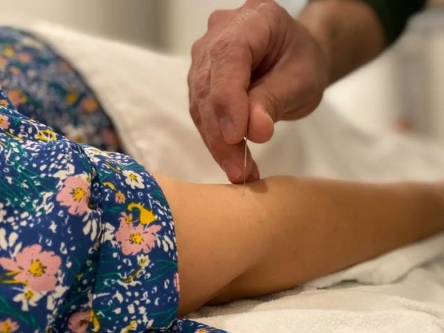acupuncture-uws