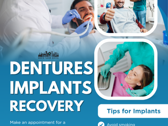 are-denture-implants-worth-it