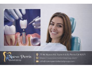 dental-implants-treatment-in-moreno-valley-dr-tejas-modi-small-0
