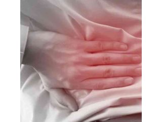 nerve-root-injury-small-0