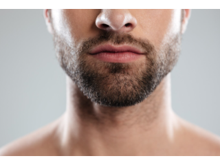confidence-starts-with-the-right-hair-restoration-small-0