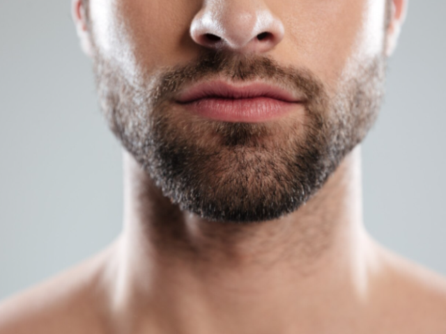 confidence-starts-with-the-right-hair-restoration
