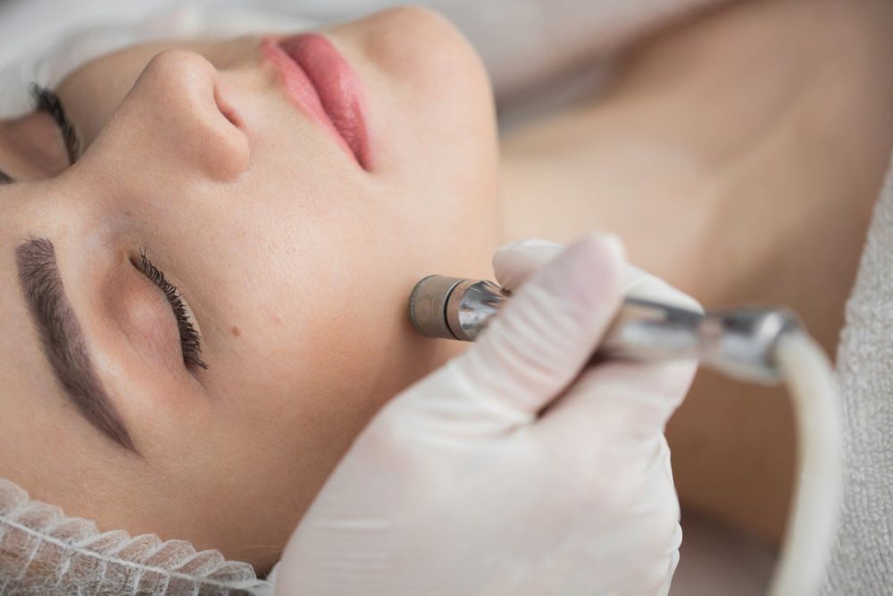 microdermabrasion-facial-in-hamilton-nj-for-smooth-skin-big-0