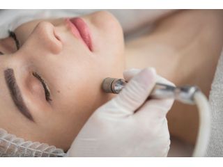 microdermabrasion-facial-in-hamilton-nj-for-smooth-skin-small-0