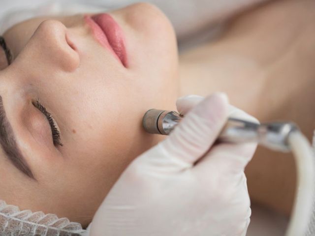microdermabrasion-facial-in-hamilton-nj-for-smooth-skin