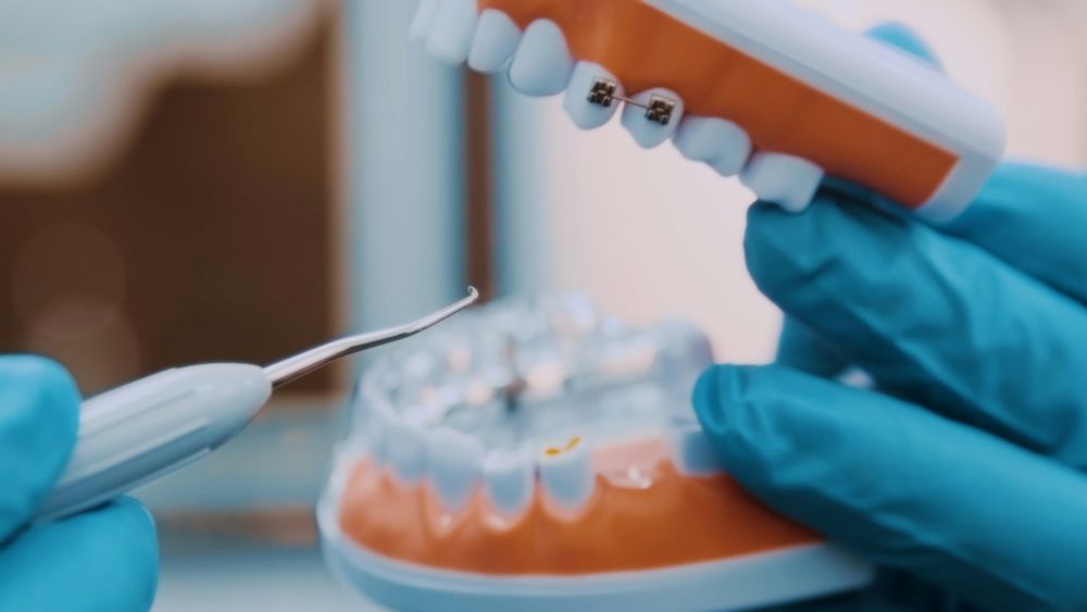 pleasant-dental-your-trusted-dentist-in-euless-tx-big-0