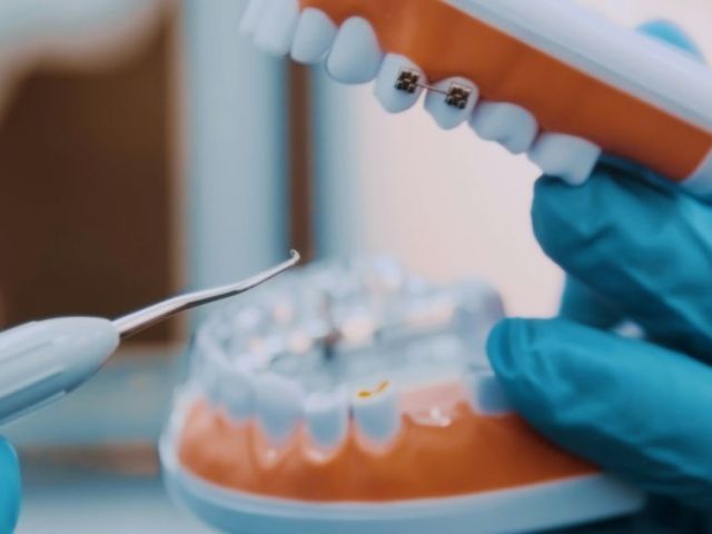 pleasant-dental-your-trusted-dentist-in-euless-tx