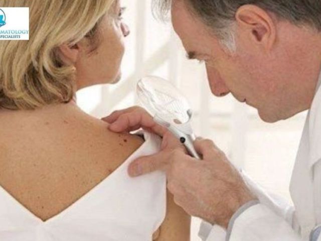 advanced-skin-cancer-treatment-in-california-book-today
